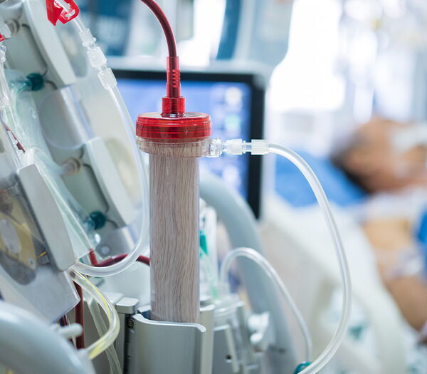 Entwicklung Steuerung Plasmapheresegerät Plasmapheresegerät mit Display und Patient im Hintergrund